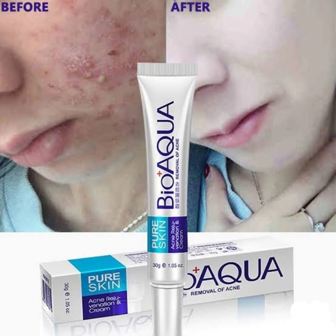 BIOAQUA Anti Acne Cream – Acne Treatment & Scar Removal Formula
