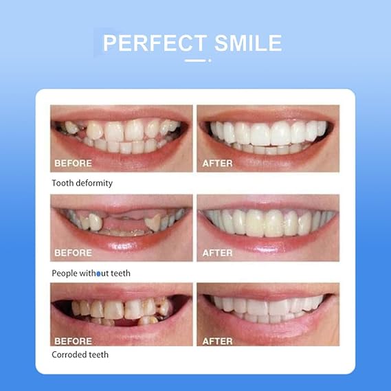 Teeth Whitening Snap-On Smile | Instant Cosmetic Teeth Cover | Removable Fake Teeth