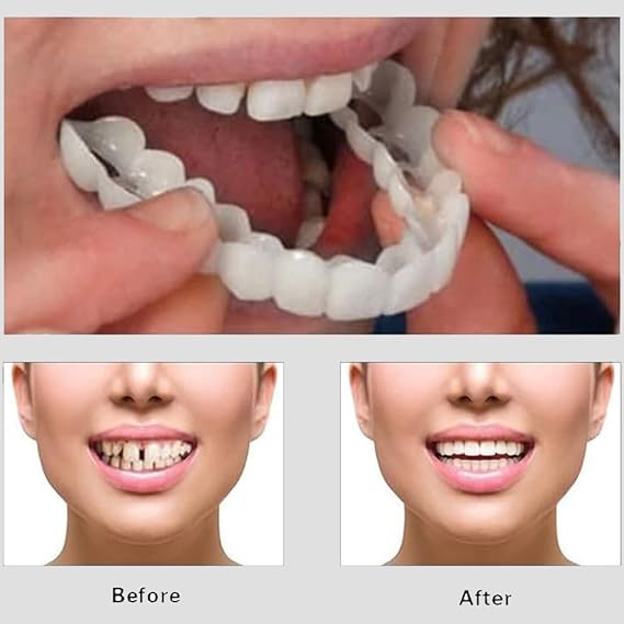Teeth Whitening Snap-On Smile | Instant Cosmetic Teeth Cover | Removable Fake Teeth