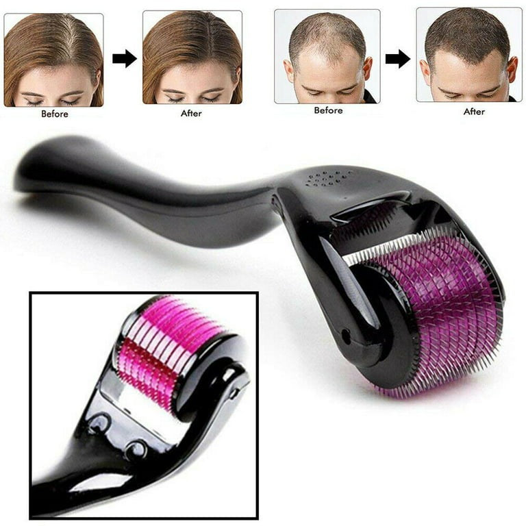 Skin Therap Micro Needle Derma Roller with 540 Needles โ Beauty Roller for Anti-Aging, Acne Scars & Skin Repair